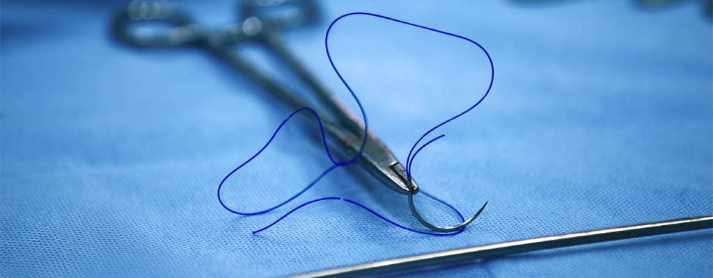 Tips Tepat Memilih Suture Ophthalmic untuk Bedah Mata Optimal