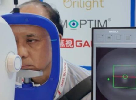 MOPTIM Mocean 4000 – OCT System Diagnosis Glaukoma