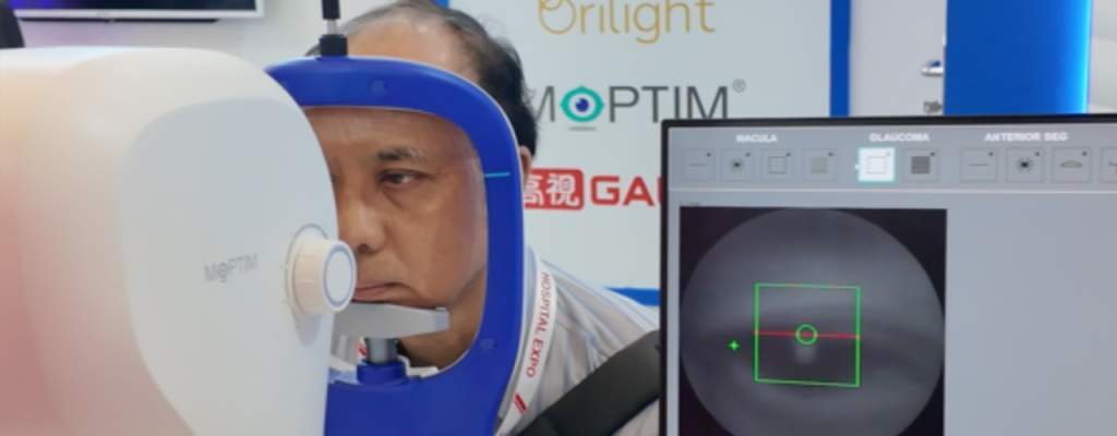 MOPTIM Mocean 4000 – OCT System Diagnosis Glaukoma